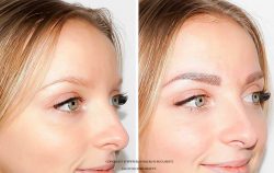 Tatuarea sprancenelor prin micropigmentare